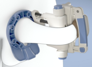 RestoreX customization and counter-bending - side